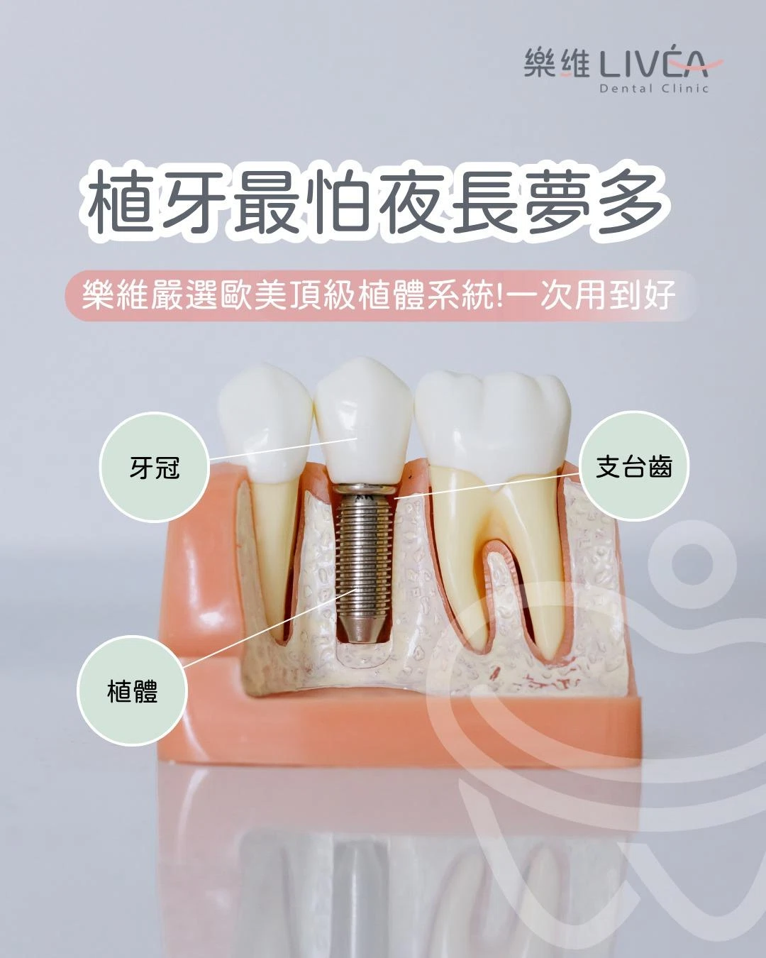 植牙最怕夜長夢多