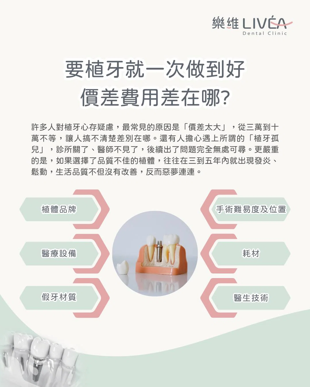 植牙最怕夜長夢多